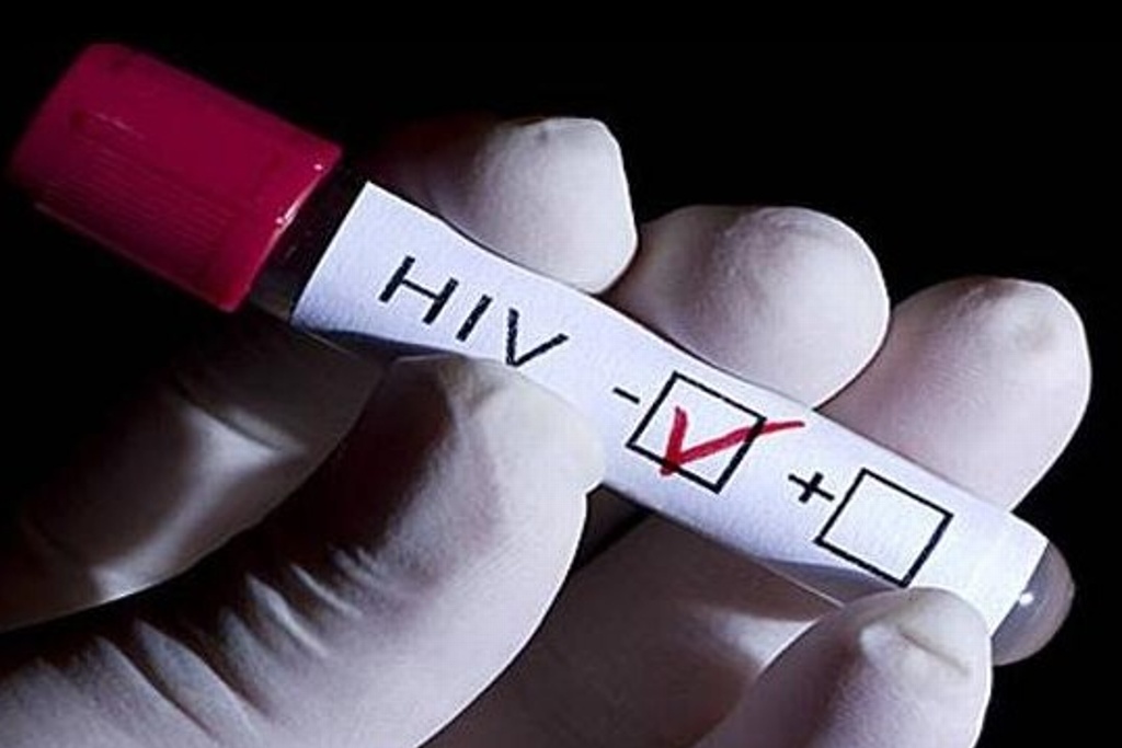 Nuevo tratamiento controla el virus del VIH causante del Sida